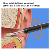 Visual Ear Cleaner